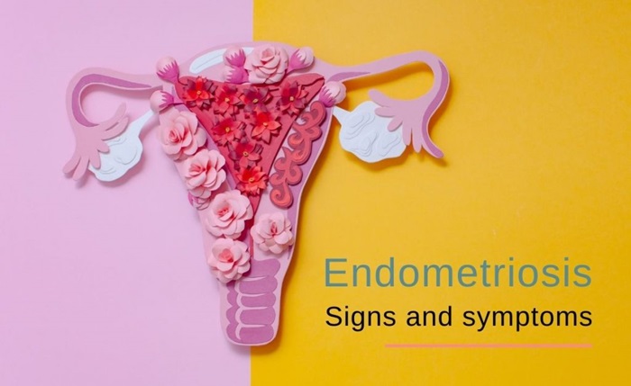 7 Signs You Might Have Endometriosis and What to Do Next