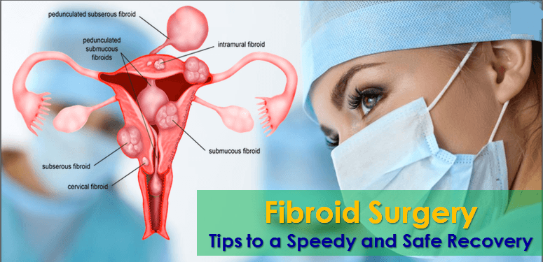 post treatment care for fibroids