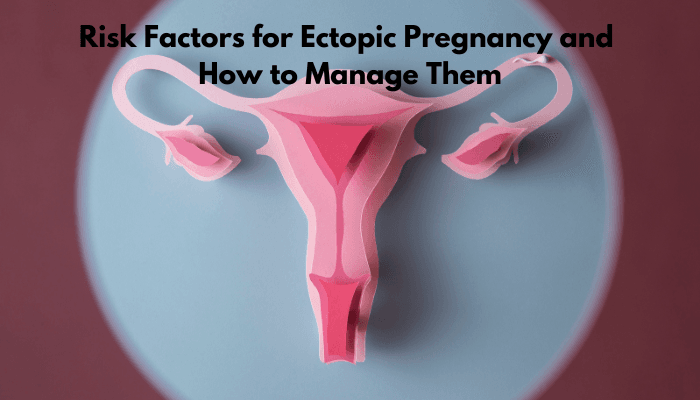 Risk Factors for Ectopic Pregnancy