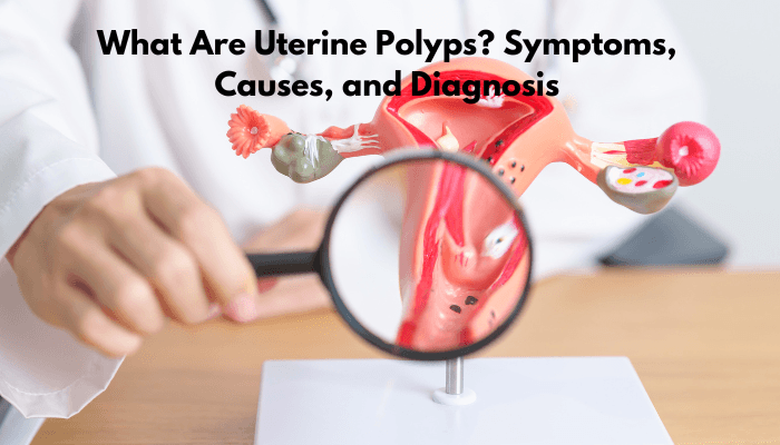 What Are Uterine Polyps