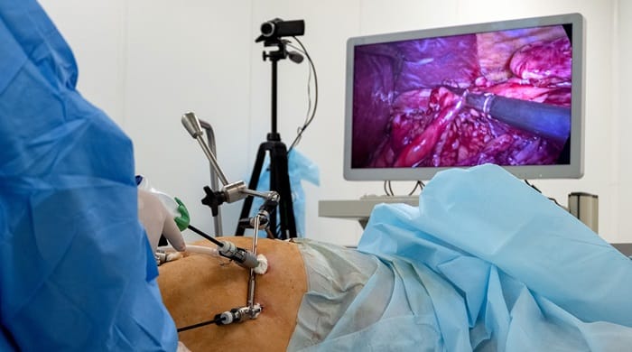 benefits of laparoscopic gynecological procedures