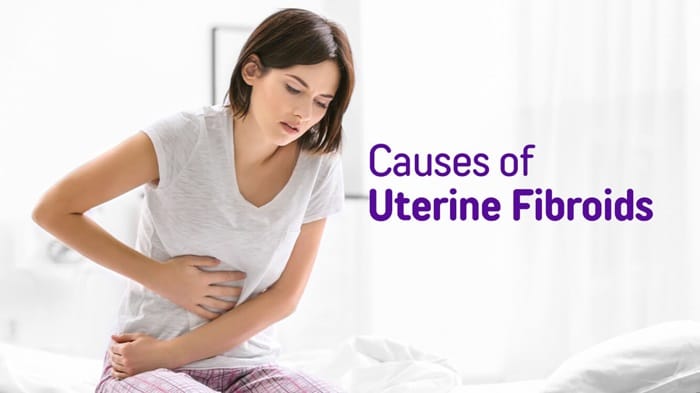 causes of uterine fibroids