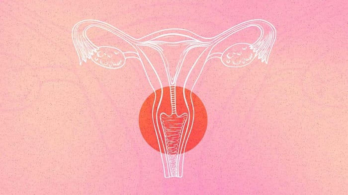 cervical cancer