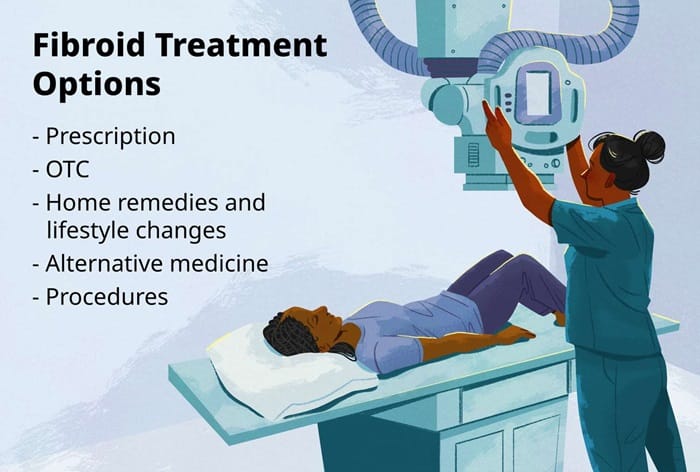 choosing right fibroid treatment