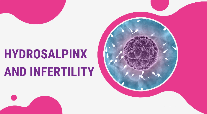 how does hydrosalpinx affect fertility