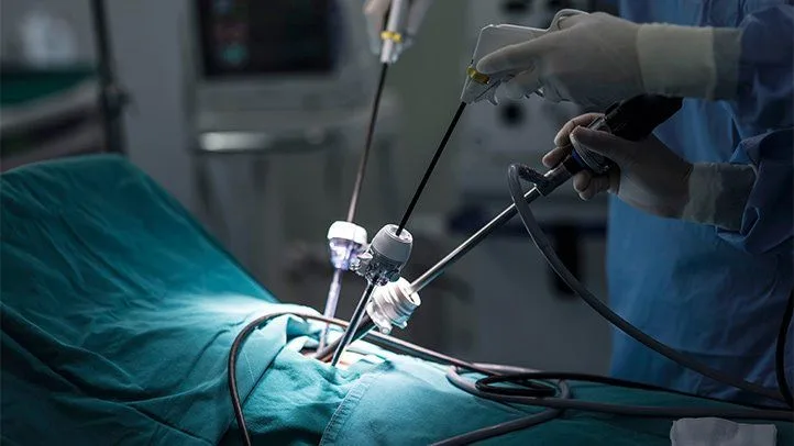 laparoscopic hysterectomy