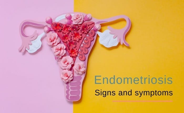 symptoms of endometriosis