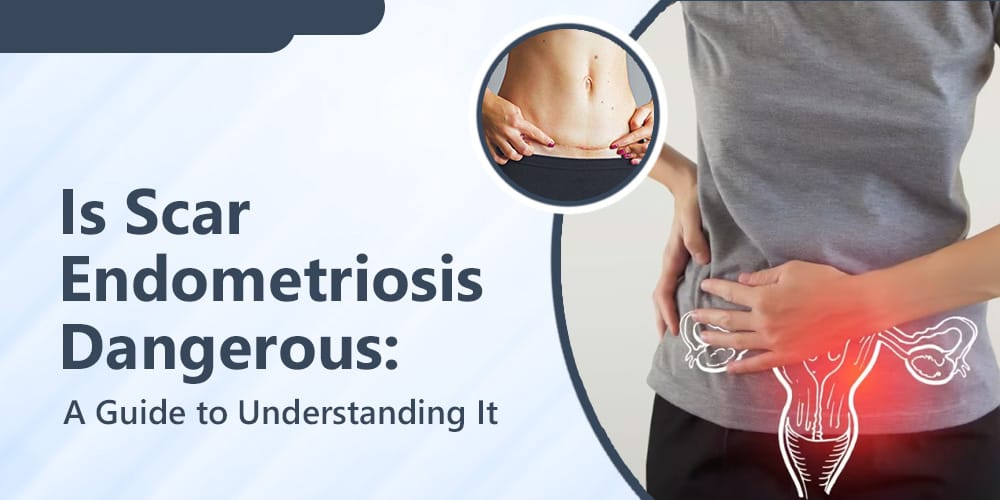 Scar Endometriosis