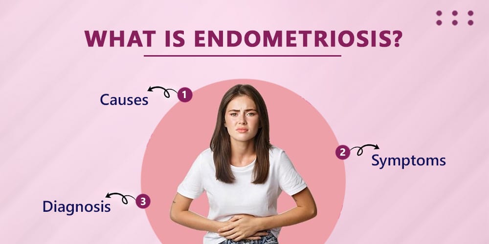 Endometriosis