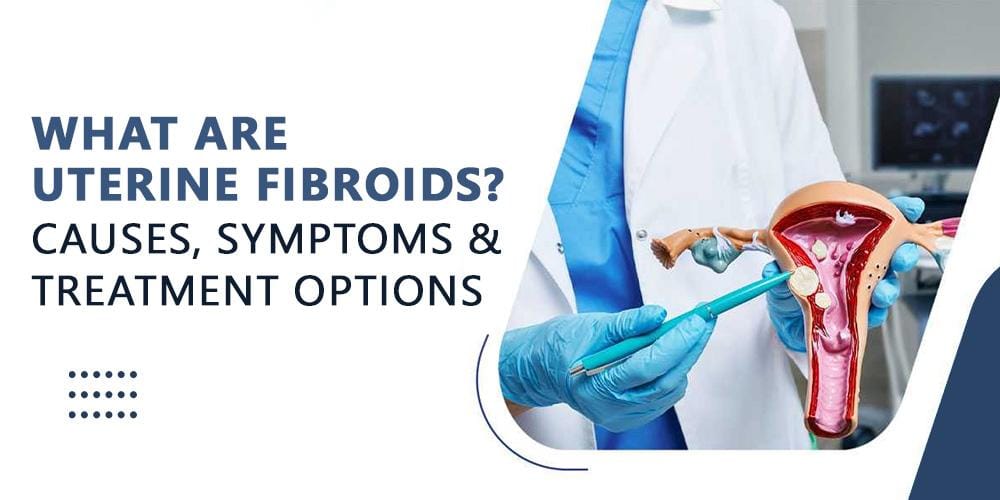 Uterine Fibroids