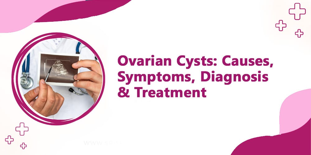 ovarian cysts treatment