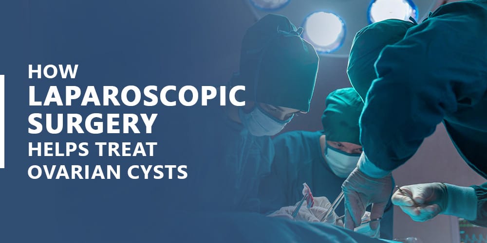Laparoscopic Surgery for Ovarian Cysts