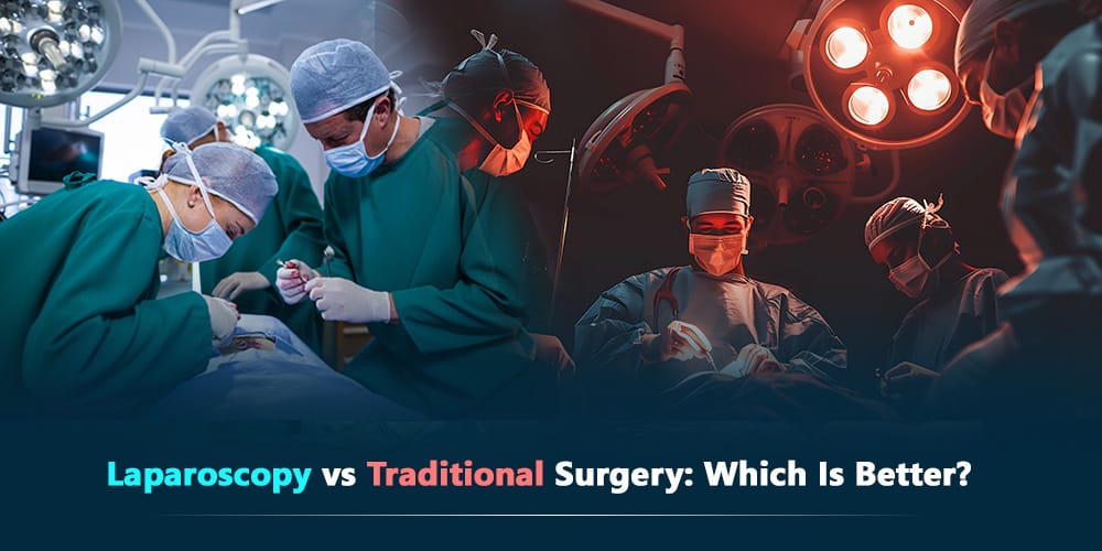 Laparoscopy vs Traditional Surgery