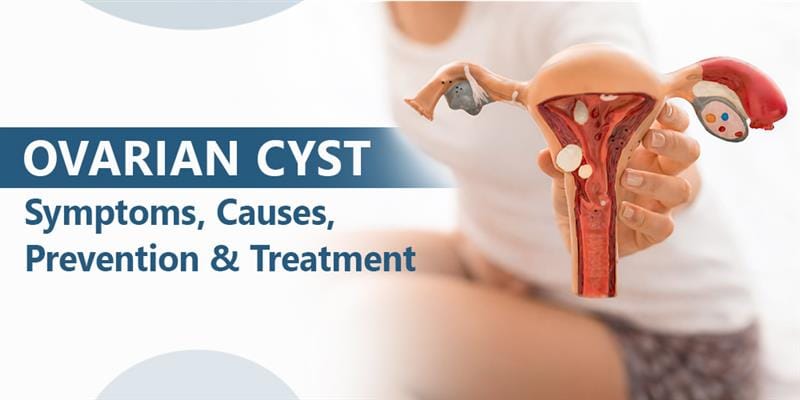 Ovarian Cyst Treatment in Jaipur