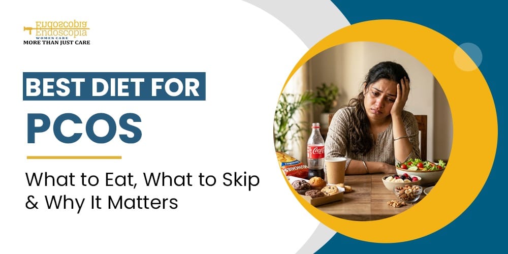 best diet for pcos