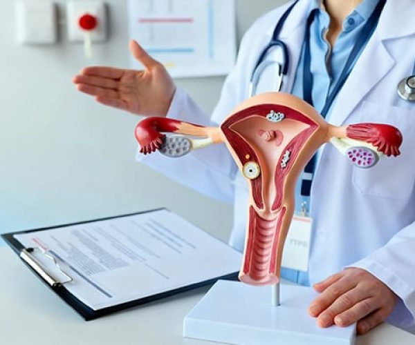 Advanced Ovarian Cyst Treatment